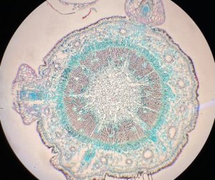Tesis “Interacción de Fusarium circinatum y Pinus pinaster&quot;